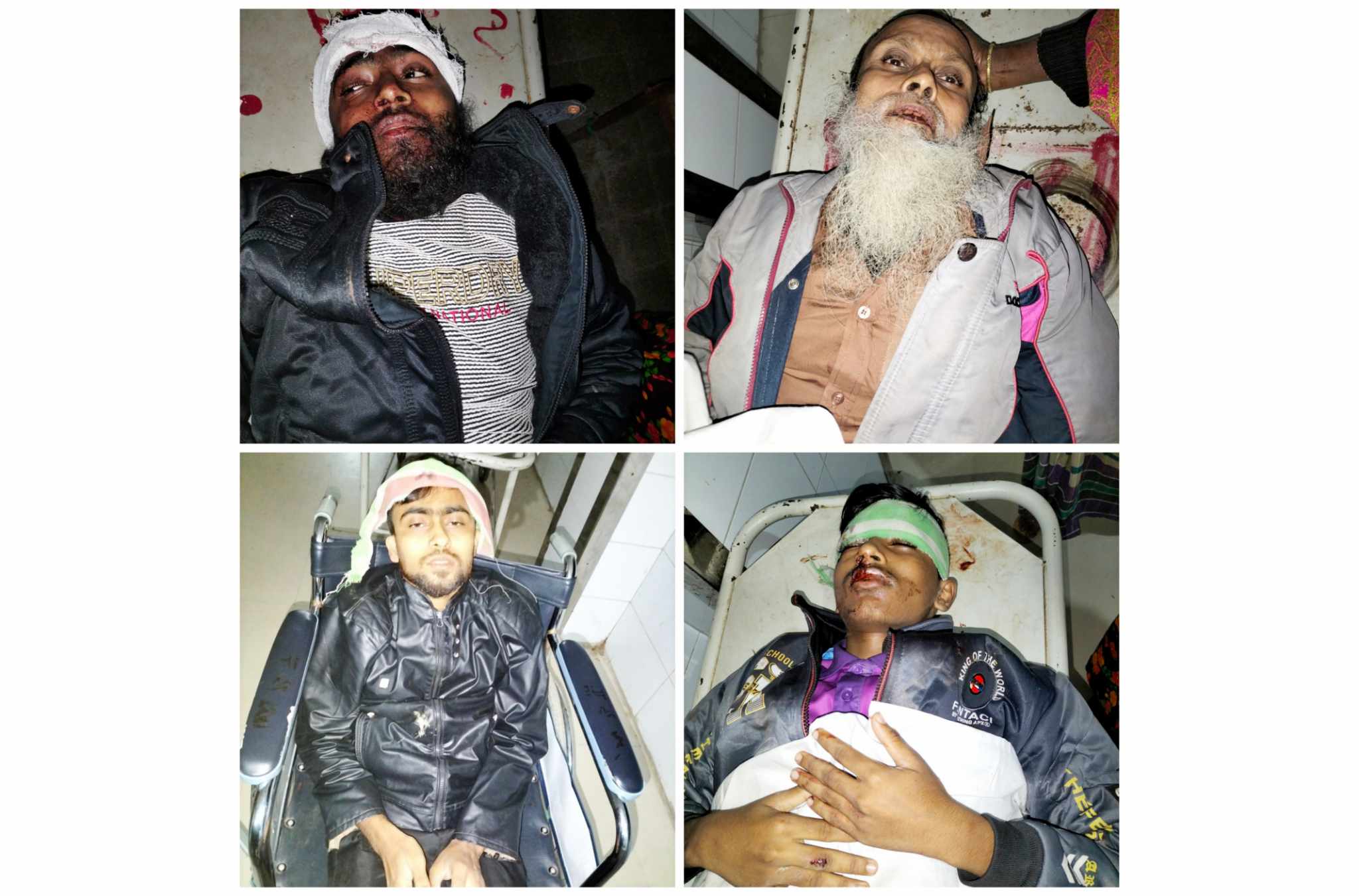 বরিশাল হরিনাফুলিয়ায় জমি নিয়ে একই পরিবারের ৪ জনকে কুপিয়ে জখম