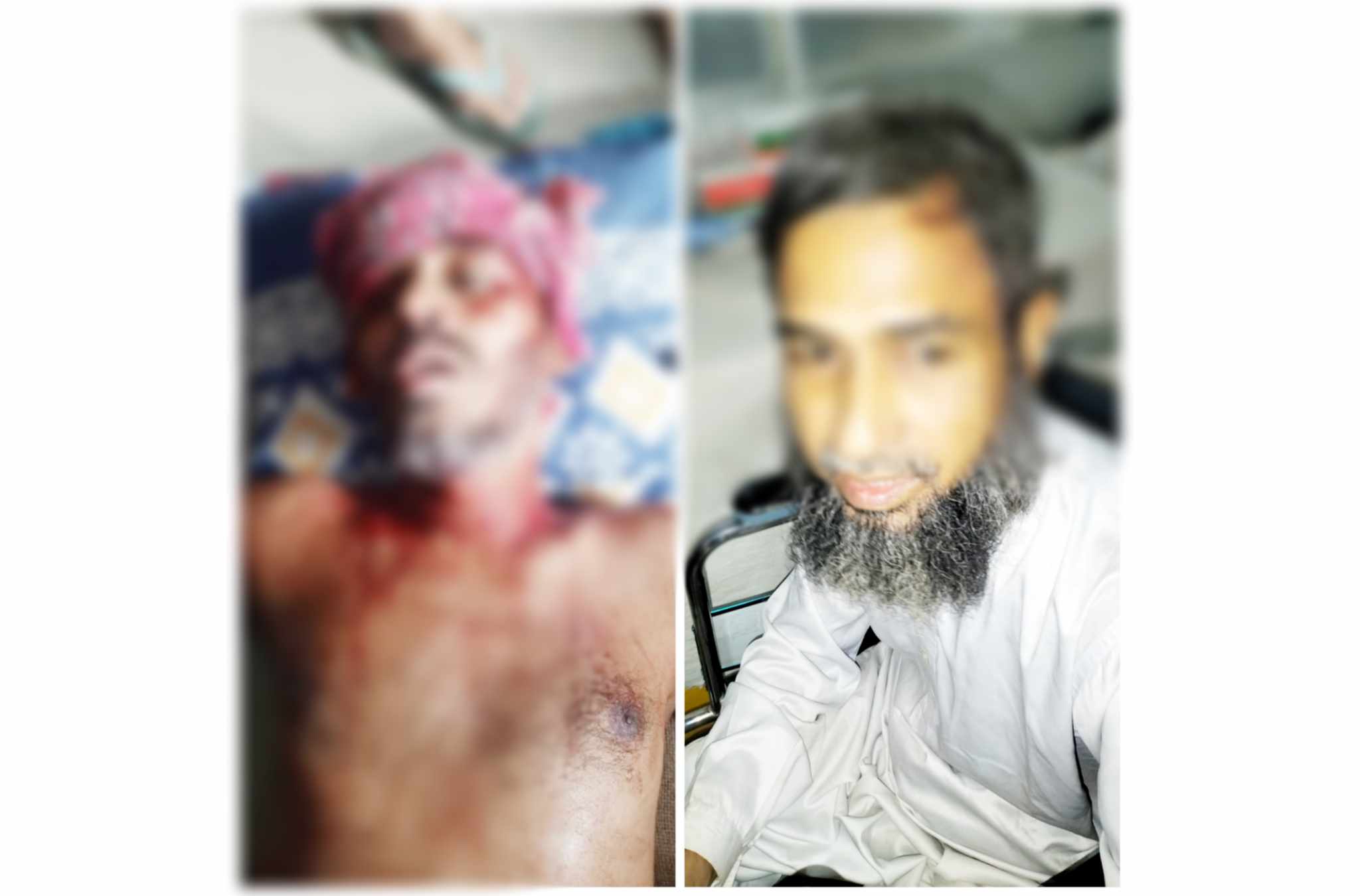 বাকেরগঞ্জের নেয়ামতিতে সন্ত্রাসী হামলায় আহত সহোদর শেবাচিমে