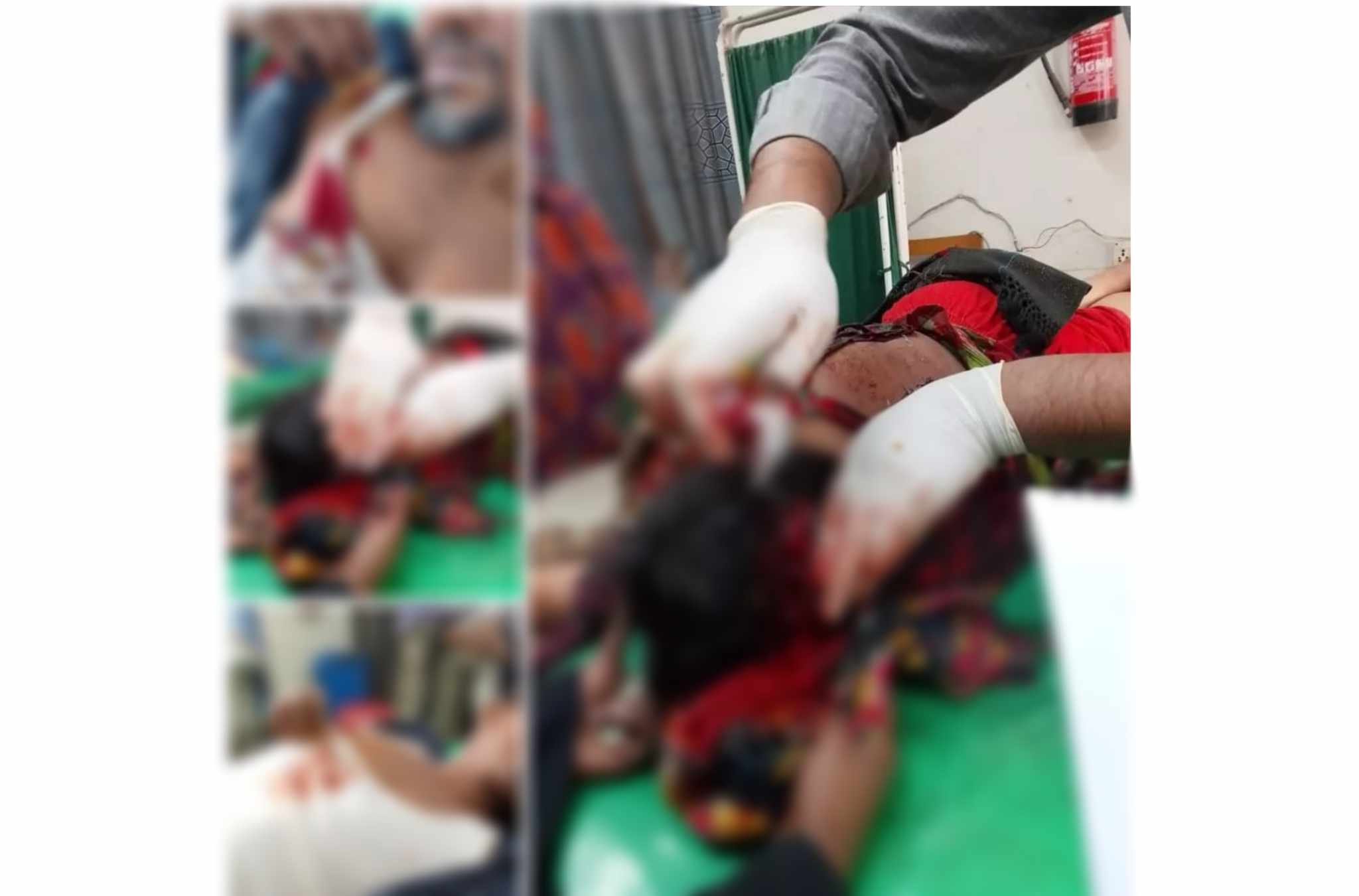 পটুয়াখালীতে তুচ্ছ ঘটনায় প্রতিবন্ধী সহ তার বাবা-মাকে কুপিয়ে হত্যা চেষ্টার অভিযোগে 