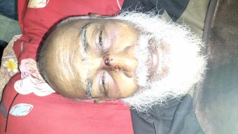 লালমোহনে পূর্ব শত্রুতার জেরে বৃদ্ধ সাইফুলকে পিটিয়ে নাকের চারা ভেঙ্গে দেয়ার অভিযোগ