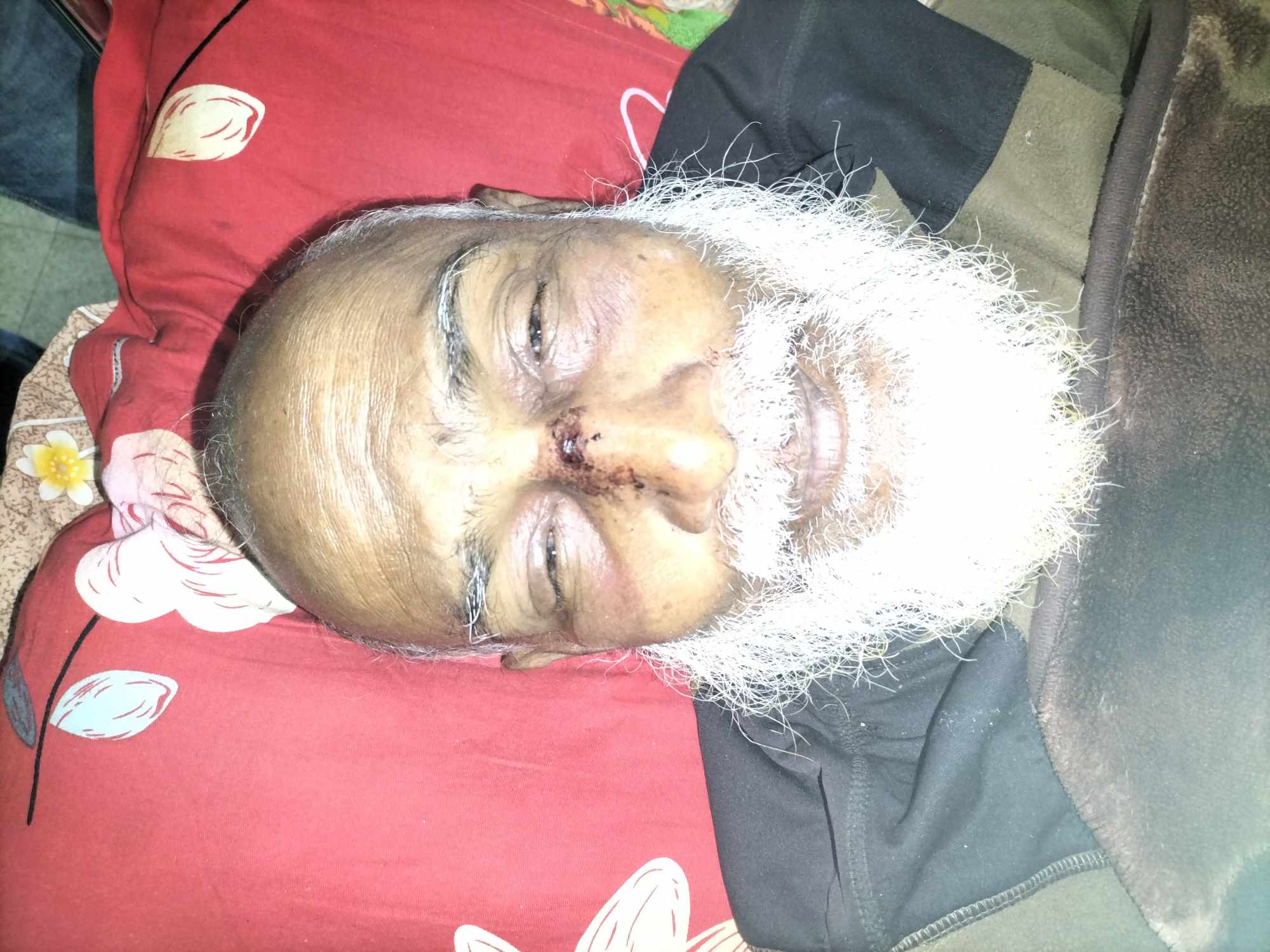 লালমোহনে পূর্ব শত্রুতার জেরে বৃদ্ধ সাইফুলকে পিটিয়ে নাকের চারা ভেঙ্গে দেয়ার অভিযোগ