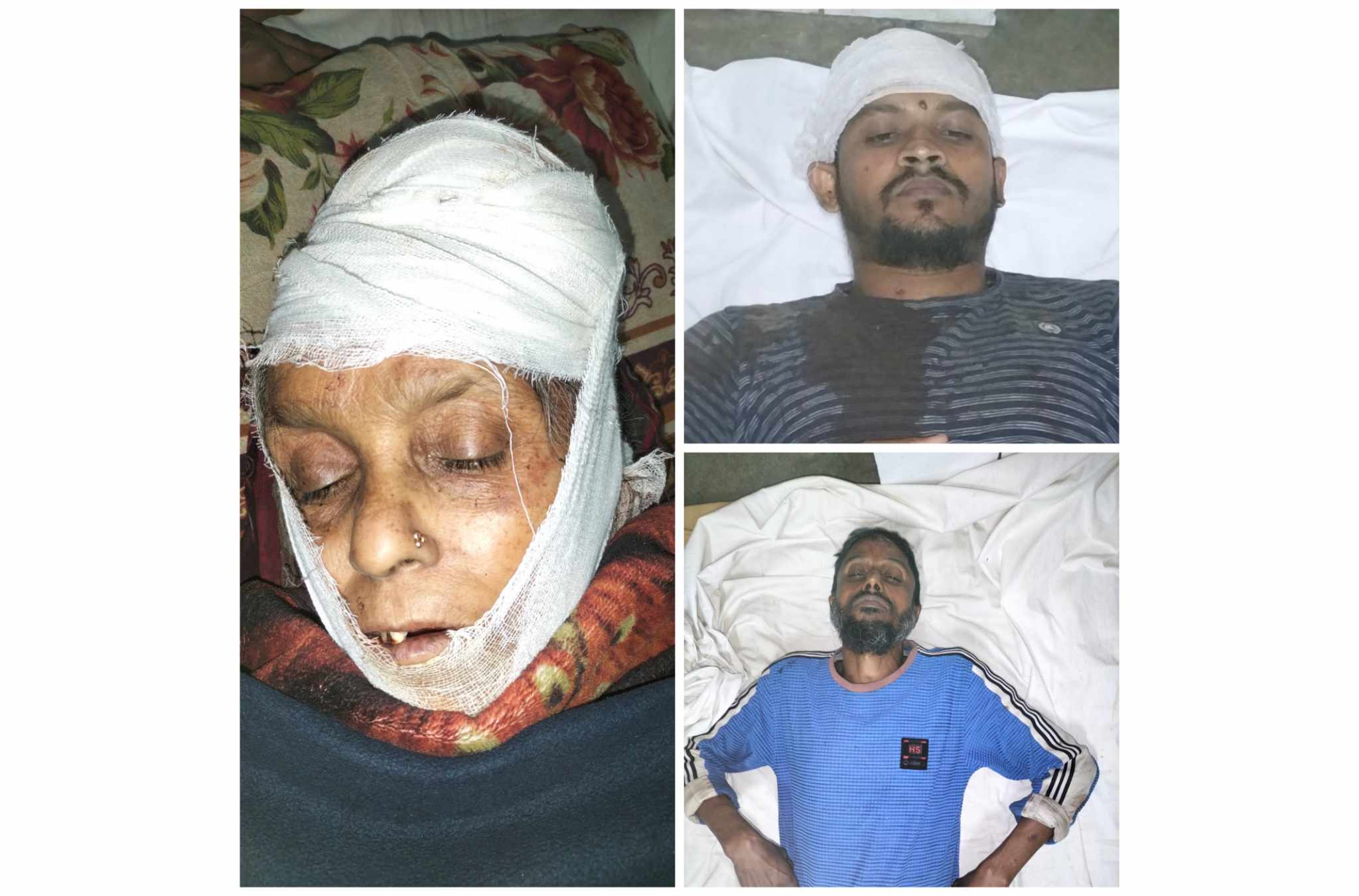 মঠবাড়িয়ায় জমি বিরোধের জের ধরে মা ও ছেলে সহ তিনজনকে কুপিয়ে জখমের অভিযোগ