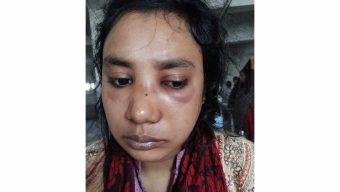 মির্জাগঞ্জে জমি দখল করতে অন্তঃসত্তা নারী সহ পরিবারের ৪ জনকে হত্যার চেষ্টা!