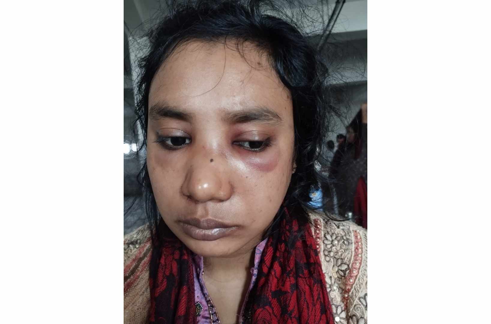 মির্জাগঞ্জে জমি দখল করতে অন্তঃসত্তা নারী সহ পরিবারের ৪ জনকে হত্যার চেষ্টা!