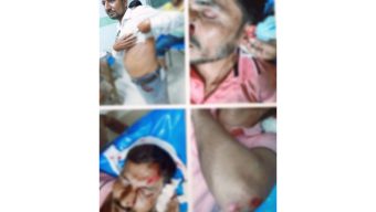 বরগুনায় ব্যবসায়ী সহ ৫ জনকে কুপিয়ে আহত, দোকান ভাঙচুর ও লুটপাটের অভিযোগ 