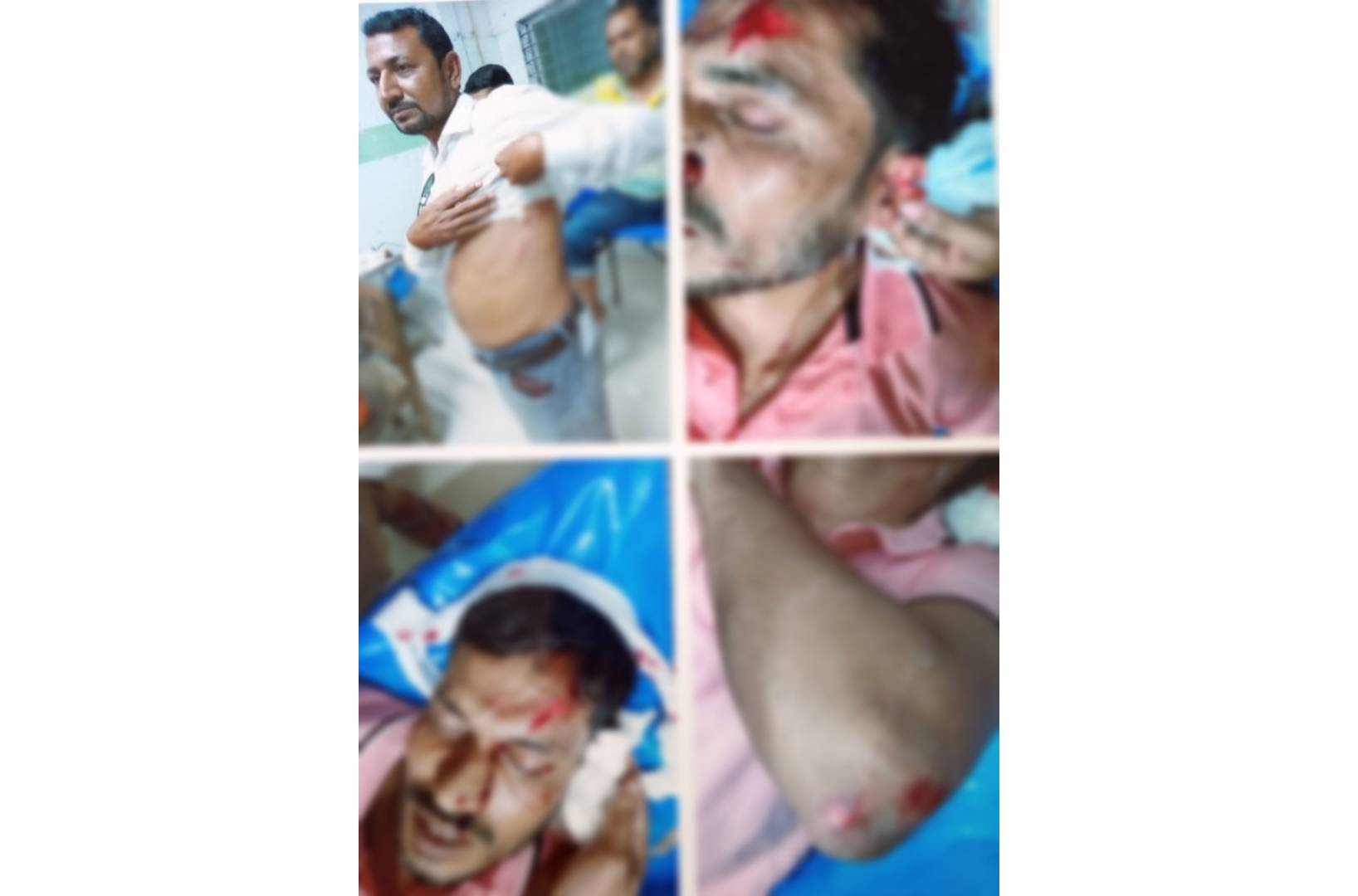 বরগুনায় ব্যবসায়ী সহ ৫ জনকে কুপিয়ে আহত, দোকান ভাঙচুর ও লুটপাটের অভিযোগ