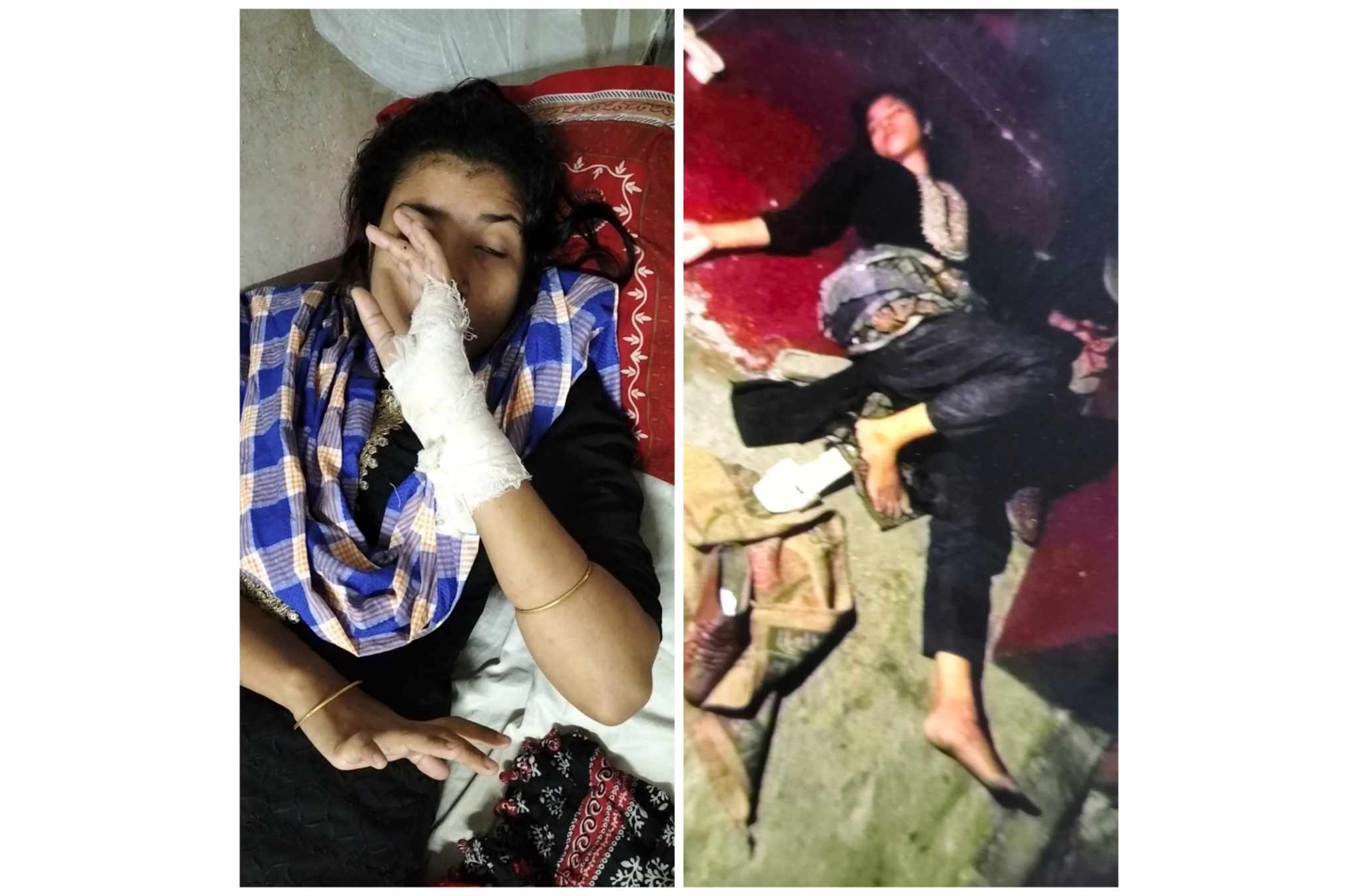 প্রেমের বিয়ে মেনে না নিয়ে নববধূকে শশুর, শাশুড়ির নির্যাতন, হাসপাতালে ভর্তি