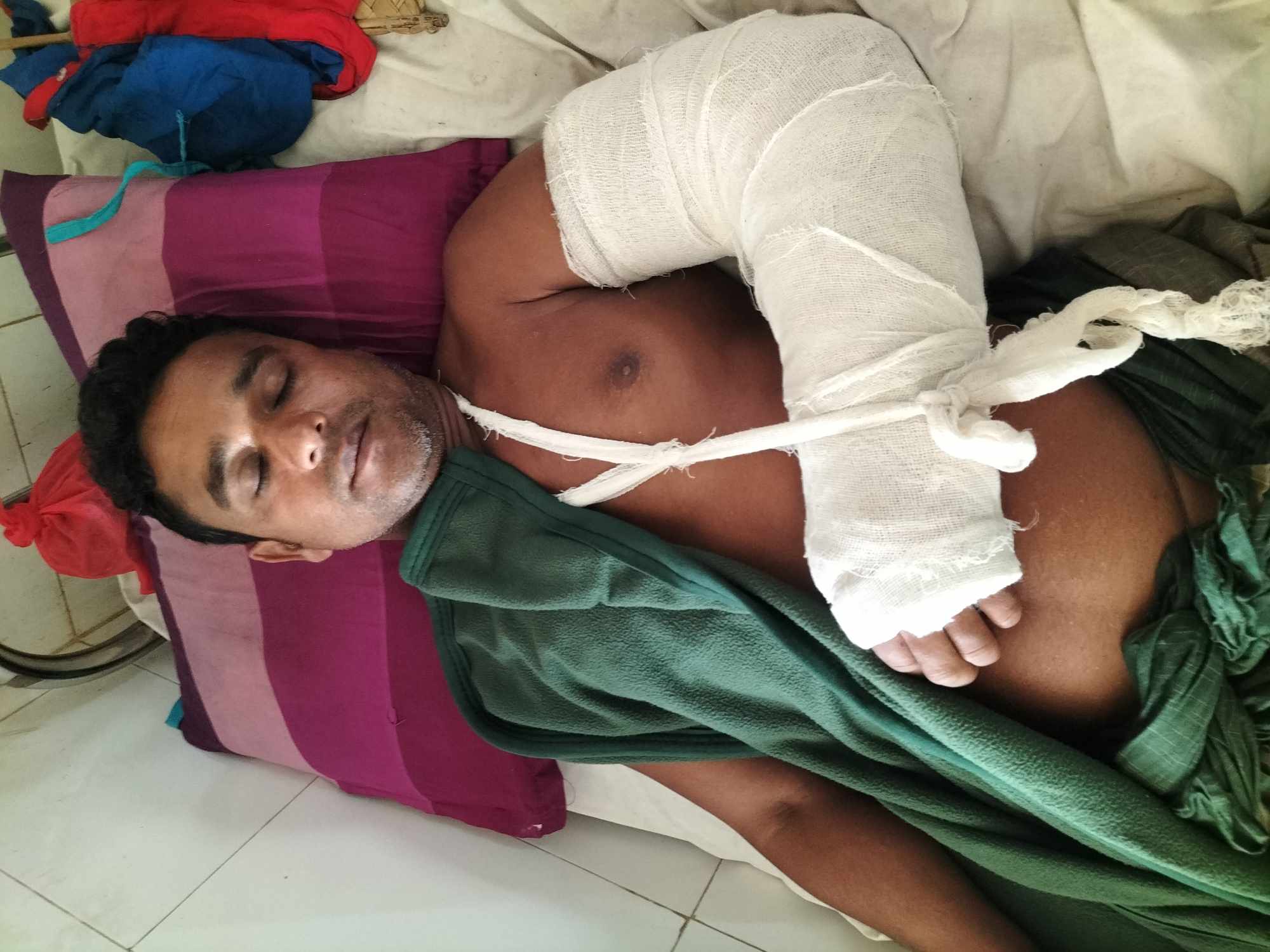 মেহেন্দিগঞ্জে দিনমজুর রিপনকে হত্যার চেষ্টায় হাত-পা ভেঙ্গে দেয়ার অভিযোগ