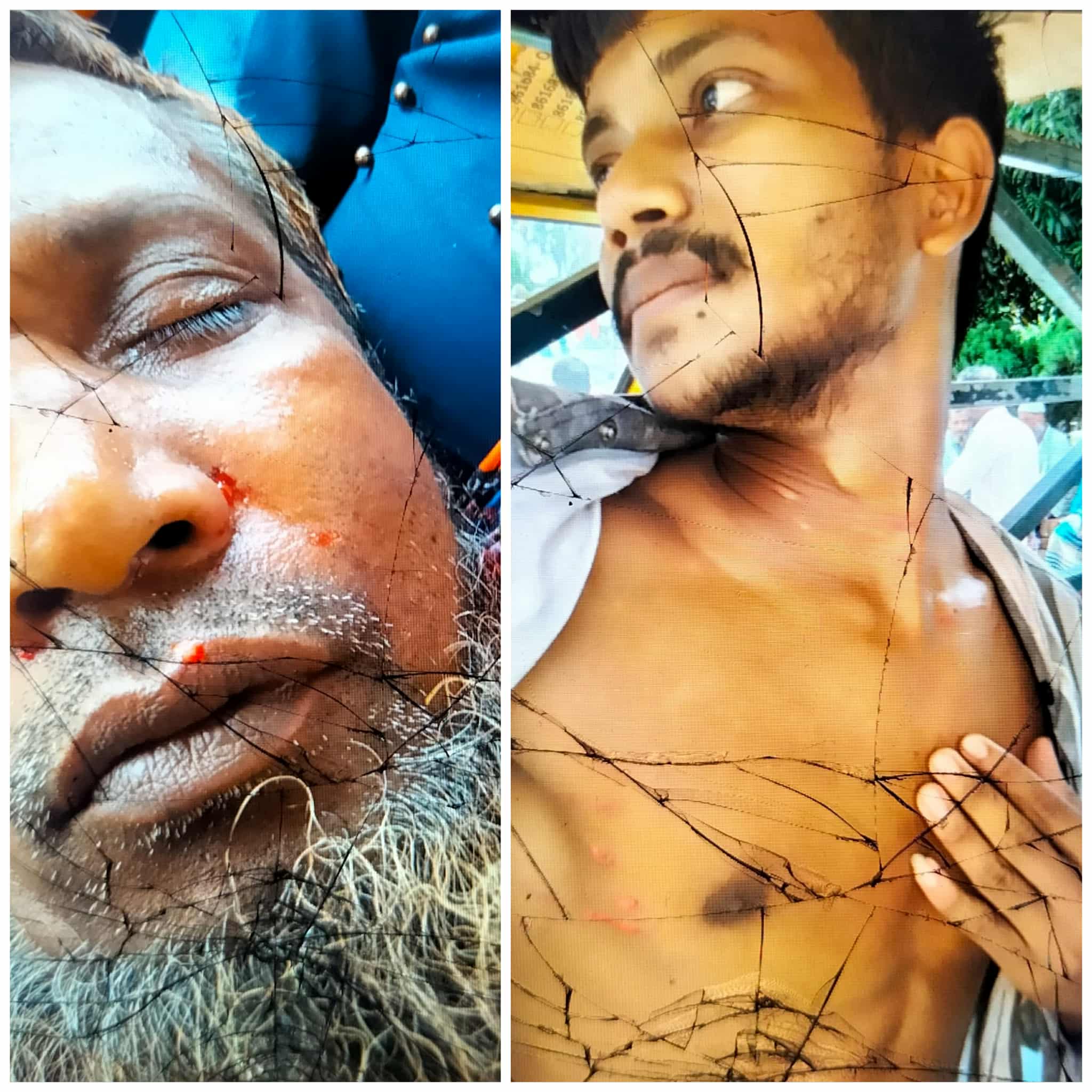 চরবাড়িয়ায় ভাইদের হামলায় ভাই সহ আহত- ৪