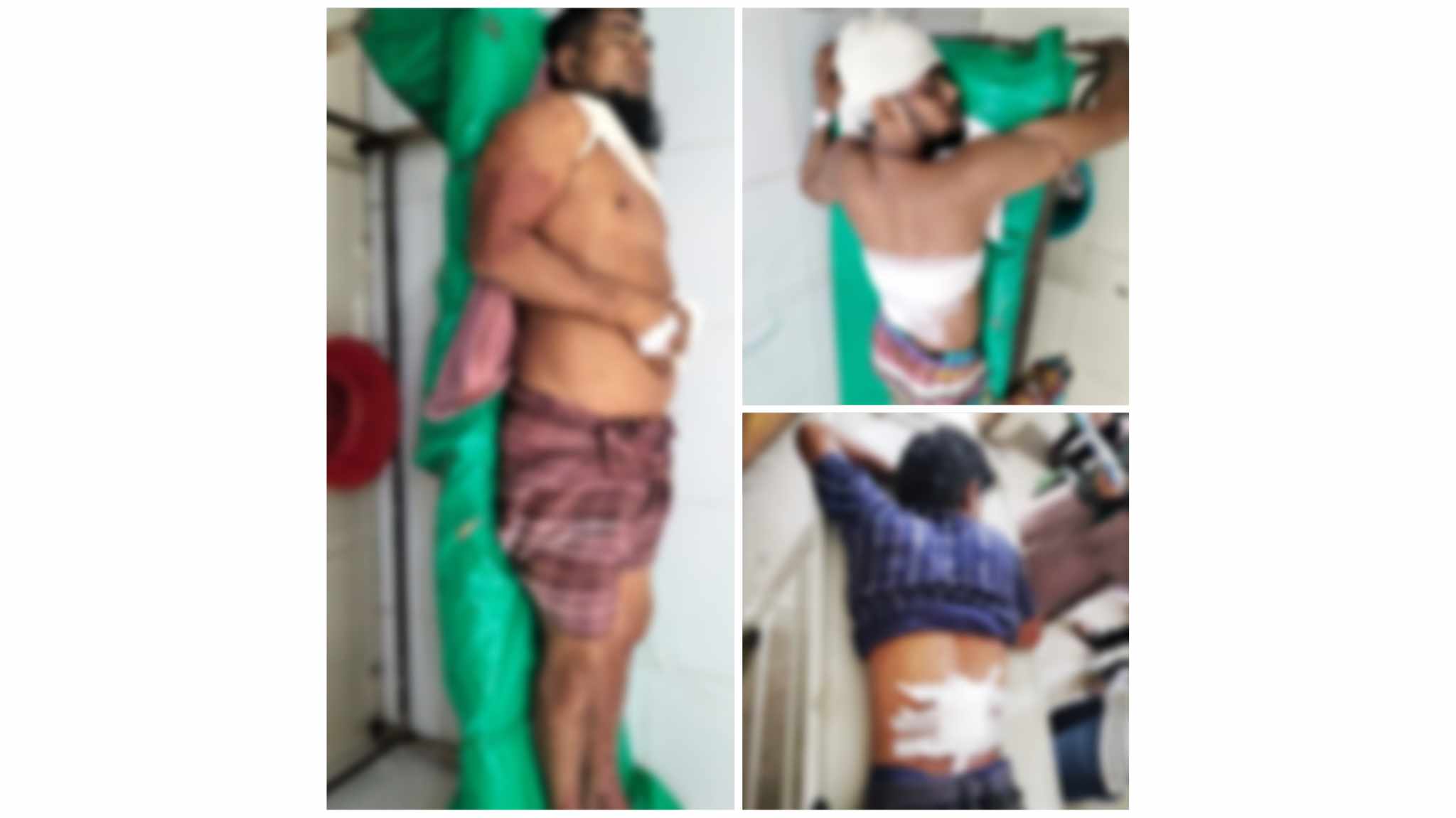 আমতলীতে চাঁদার দাবিতে গানম্যান সহ ৩ জনকে  কুপিয়ে হত্যা চেষ্টার অভিযোগ 
