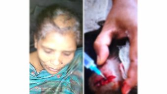 বাউফলে ছোট ভাইয়ের স্ত্রীকে কুপিয়েছে বড় ভাই ও তার সহযোগীরা 