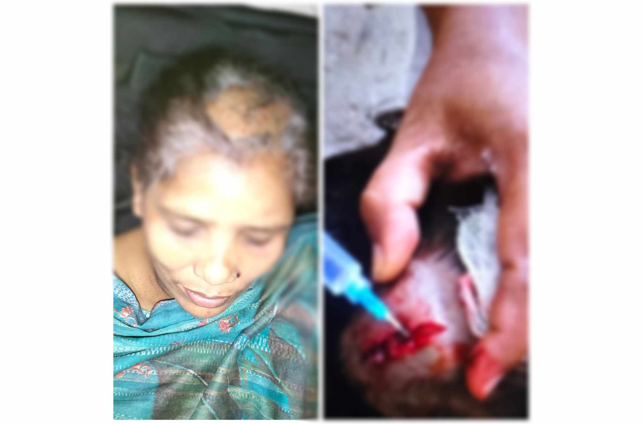 বাউফলে ছোট ভাইয়ের স্ত্রীকে কুপিয়েছে বড় ভাই ও তার সহযোগীরা 