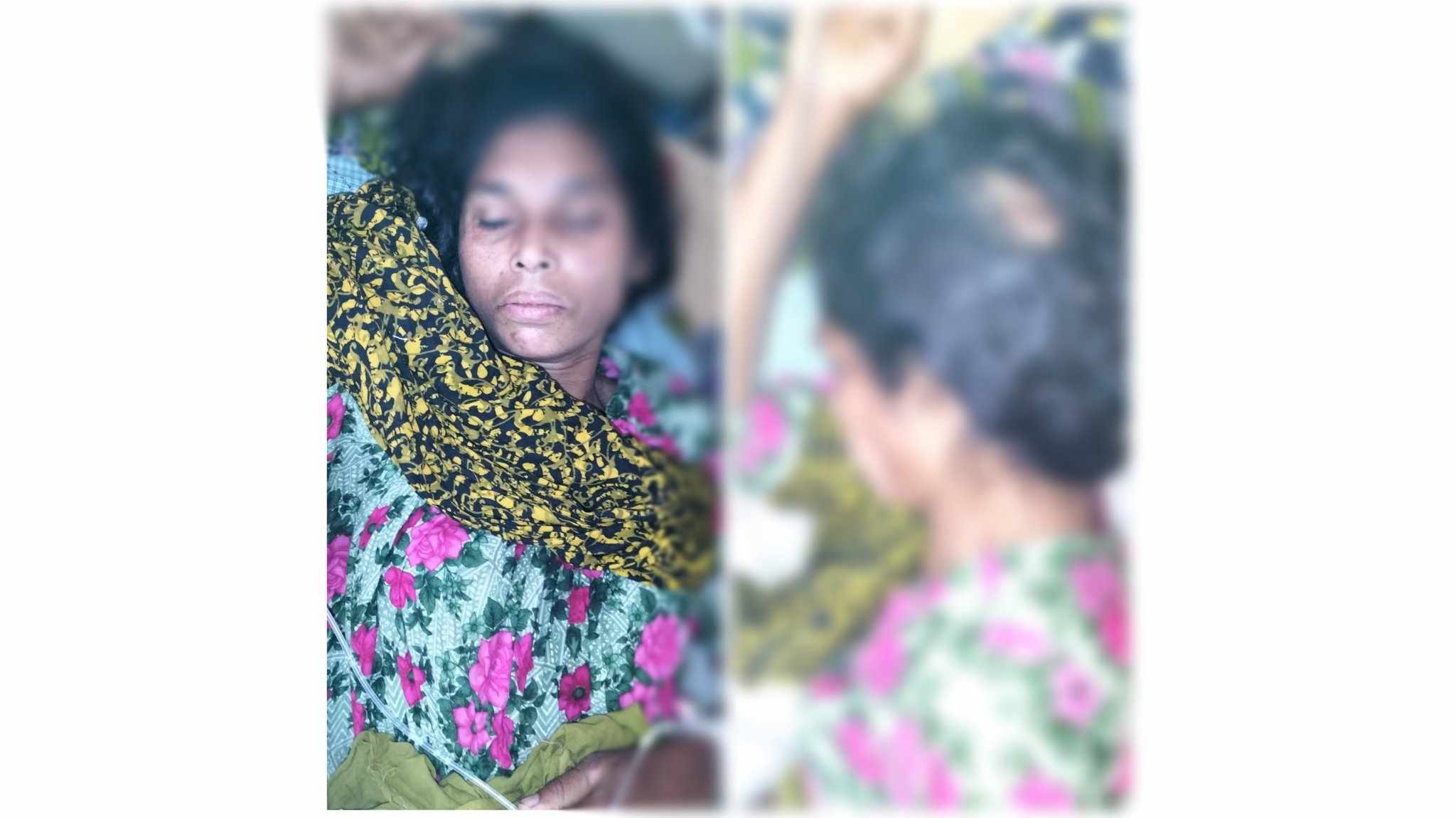 বরগুনায় জমি নিয়ে দ্বন্দ্বে নারীকে হত্যার চেষ্টায় কুপিয়ে জখমের অভিযোগ 