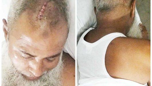 ভোলার দৌলতখানে জমি নিয়ে সংঘর্ষে অন্তঃসত্ত্বা নারী – পুরুষ সহ আহত -৭