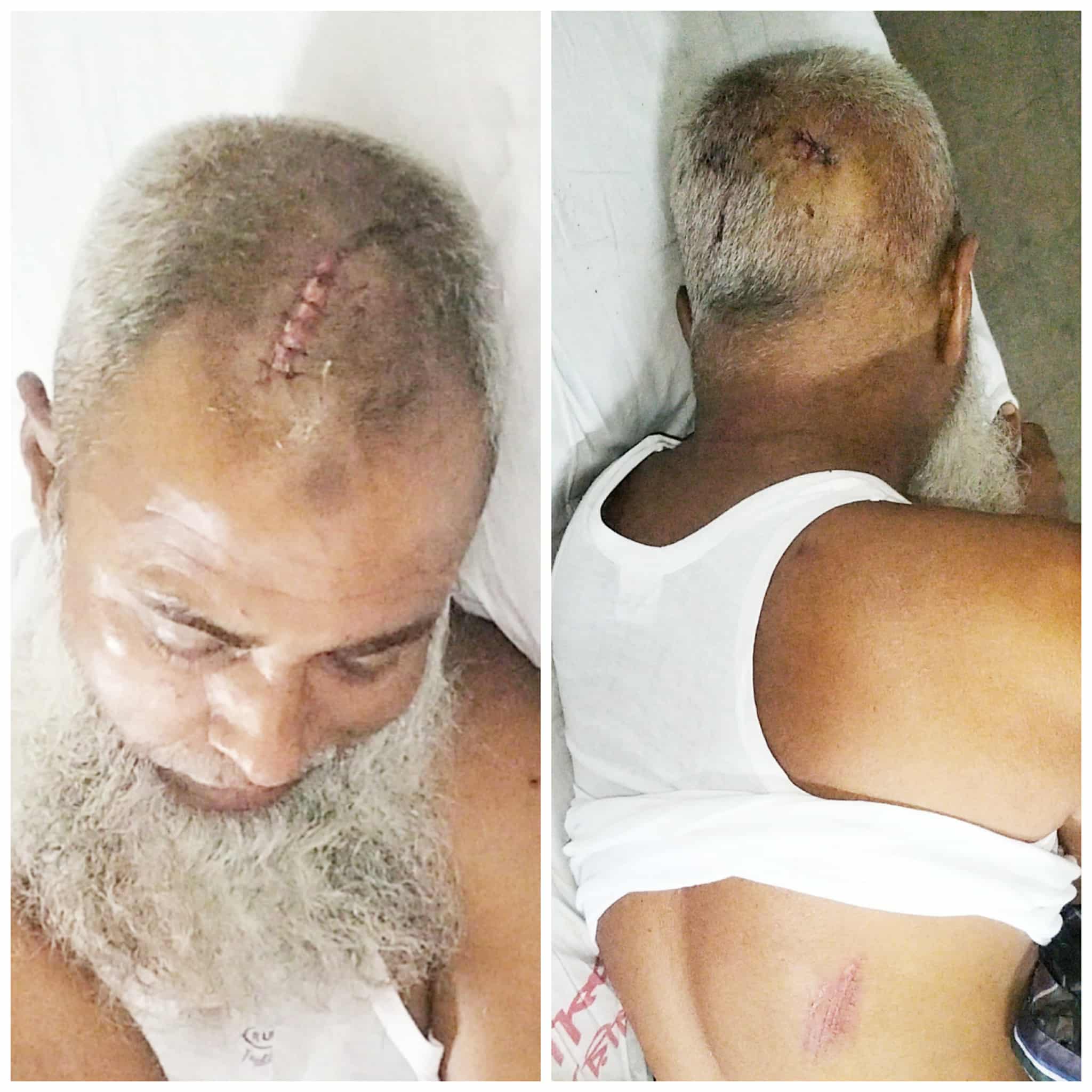 ভোলার দৌলতখানে জমি নিয়ে সংঘর্ষে অন্তঃসত্ত্বা নারী – পুরুষ সহ আহত -৭