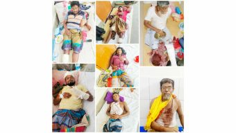 ভান্ডারিয়ায় জমি নিয়ে সংঘর্ষে রিয়াজ বাহিনীর হামলায় আহত -৭