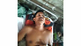 প্রথম পক্ষের স্ত্রীর নির্দেশে স্বামীকে হত্যা চেষ্টার অভিযোগ,শেবাচিমের ভর্তি