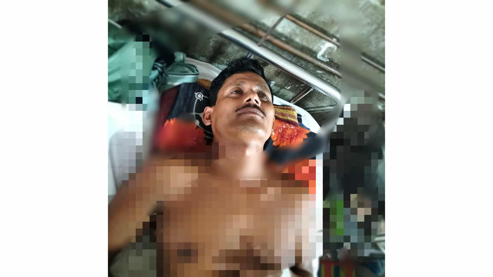 প্রথম পক্ষের স্ত্রীর নির্দেশে স্বামীকে হত্যা চেষ্টার অভিযোগ,শেবাচিমের ভর্তি