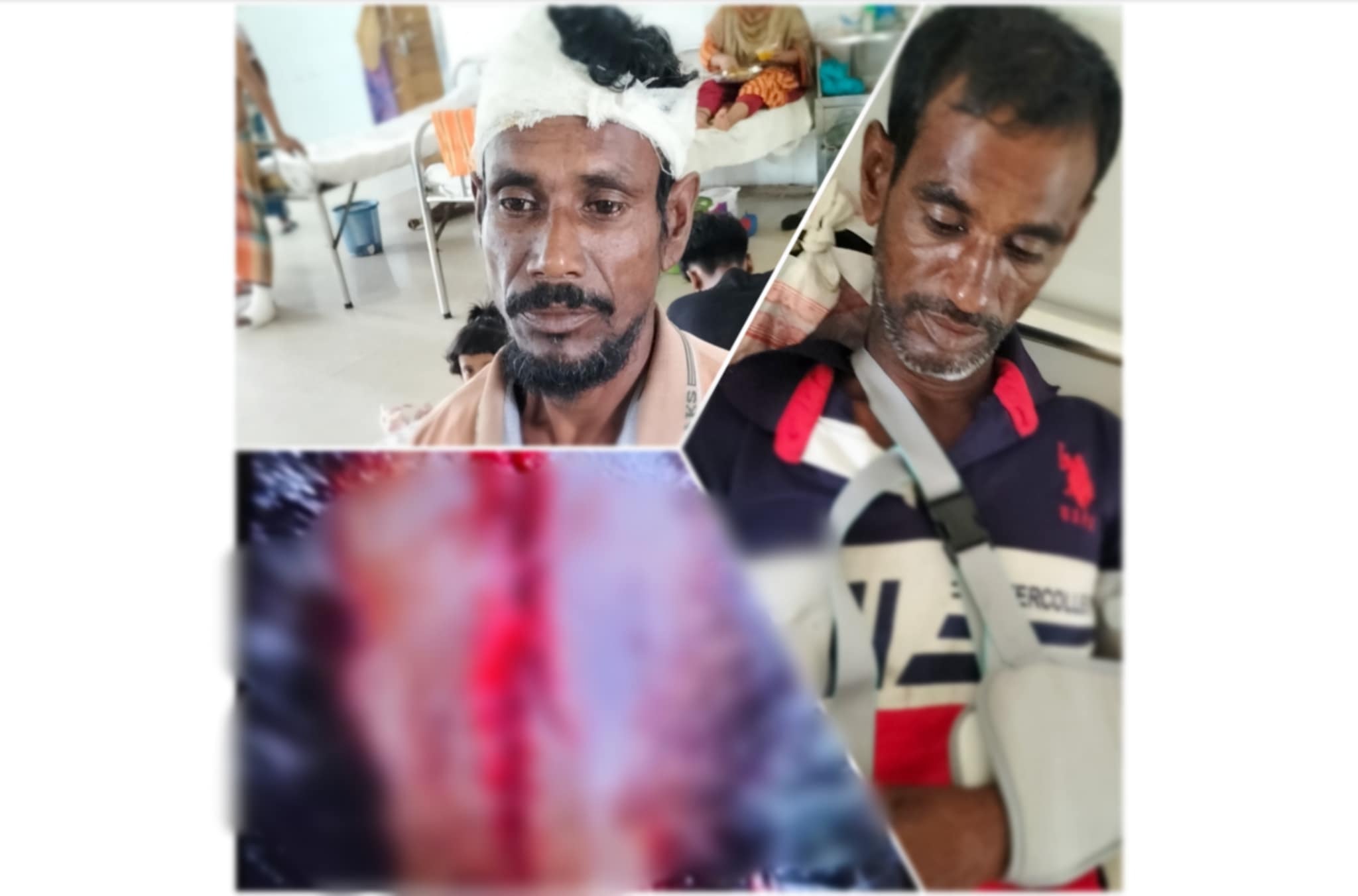 মঠবাড়িয়ায় পূর্ব শত্রুতার জের, সহোদর সহ আহত- ৪