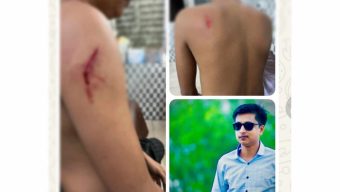 পৌর ছাত্রদলের সাবেক দপ্তর সম্পাদক কে কুপিয়ে হত্যা চেষ্টার অভিযোগ 