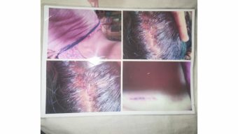 তালতলীতে প্রবাসী নারীকে হত্যার চেষ্টায় হামলার ঘটনায় মামলা দায়ের 