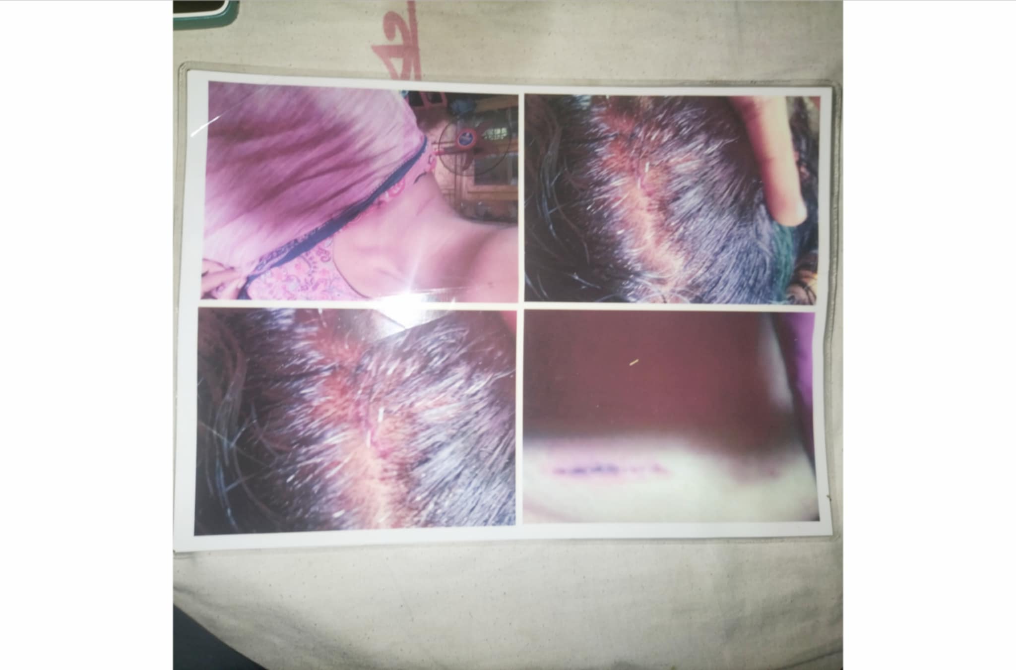 তালতলীতে প্রবাসী নারীকে হত্যার চেষ্টায় হামলার ঘটনায় মামলা দায়ের 