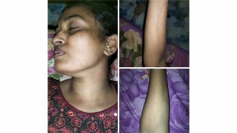 কাশীপুরে গোপনে বিয়ে ও যৌতুক নিয়ে স্বামী- স্ত্রীর মধ্যে দ্বন্দ্ব,আহত -৩