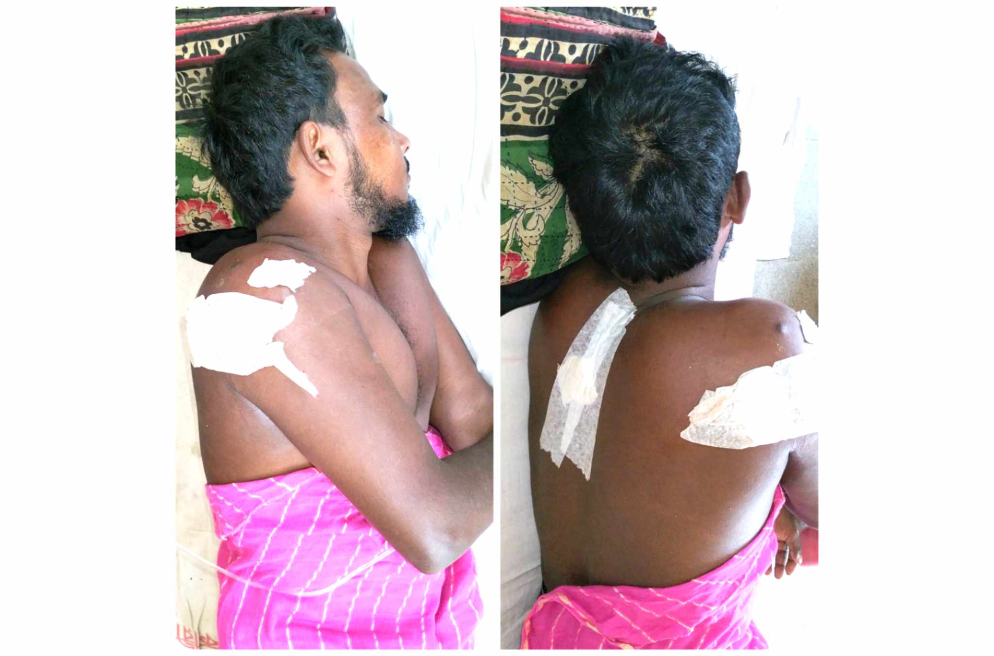 বাউফলে জামিনে বের হয়ে বাদীর ভাইকে কুপিয়ে হত্যা চেষ্টা অভিযোগ