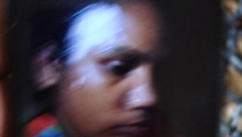 পটুয়াখালীতে স্বামী, শশুর ও শাশুড়ির নির্যাতনের শিকার গৃহবধূ হাসপাতালে