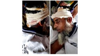 কাঠালিয়ায় গাছ কাটাকে কেন্দ্র করে দিনমজুরকে কুপিয়ে জখমের অভিযোগ
