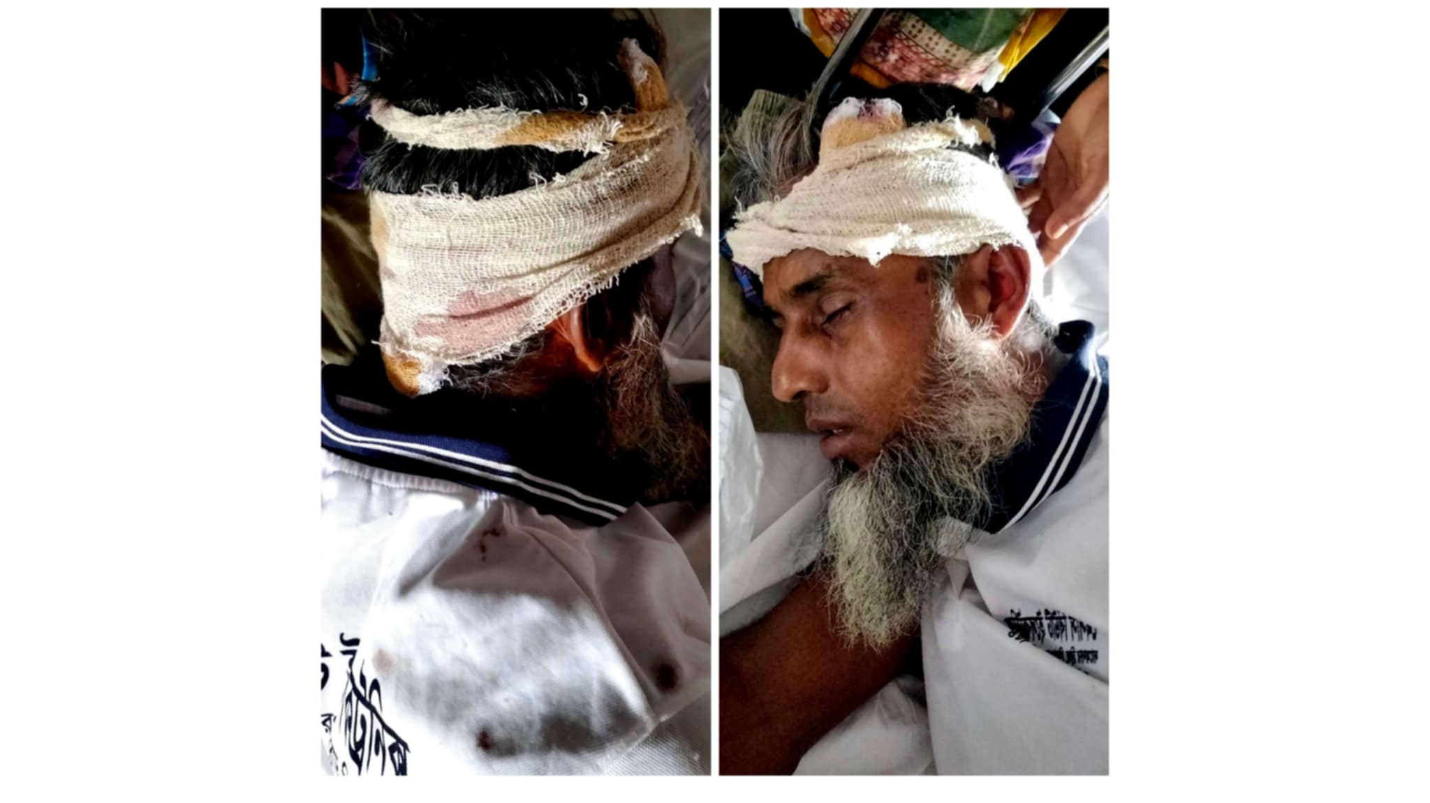 কাঠালিয়ায় গাছ কাটাকে কেন্দ্র করে দিনমজুরকে কুপিয়ে জখমের অভিযোগ