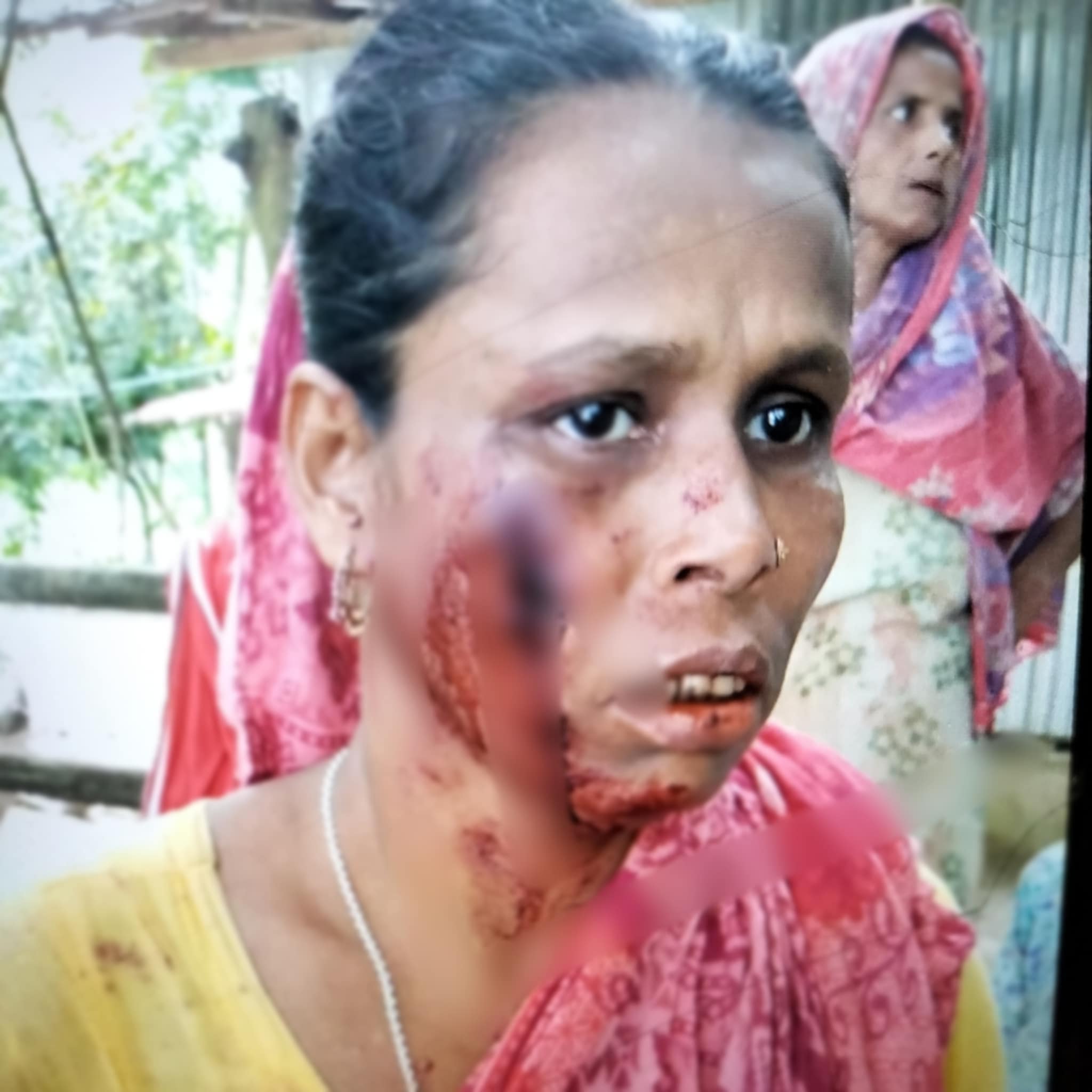 বাকেরগঞ্জের দুধলে তুচ্ছ ঘটনায় এক নারীকে পিটিয়ে রক্তাক্তের অভিযোগ