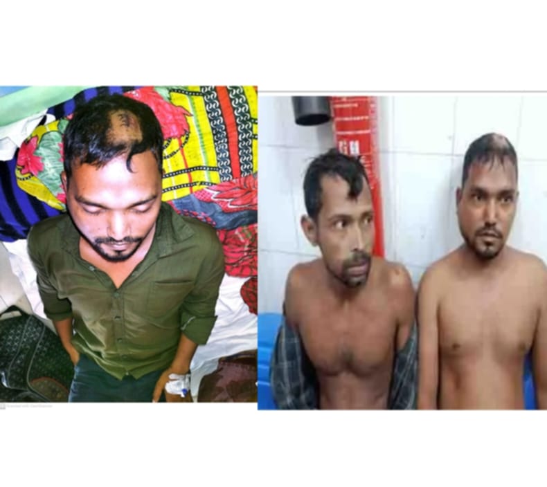 আমতলীতে জমি নিয়ে সংঘর্ষে রক্তাক্ত, আহত- ৩