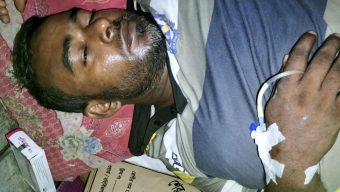 কাউনিয়ায় বড় ভাইকে ইট দিয়ে পিটিয়ে মাথার চারা ভেঙ্গে দেয়ার অভিযোগ 