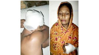 মির্জাগঞ্জে মা-ছেলেকে কুপিয়ে জখমের অভিযোগ