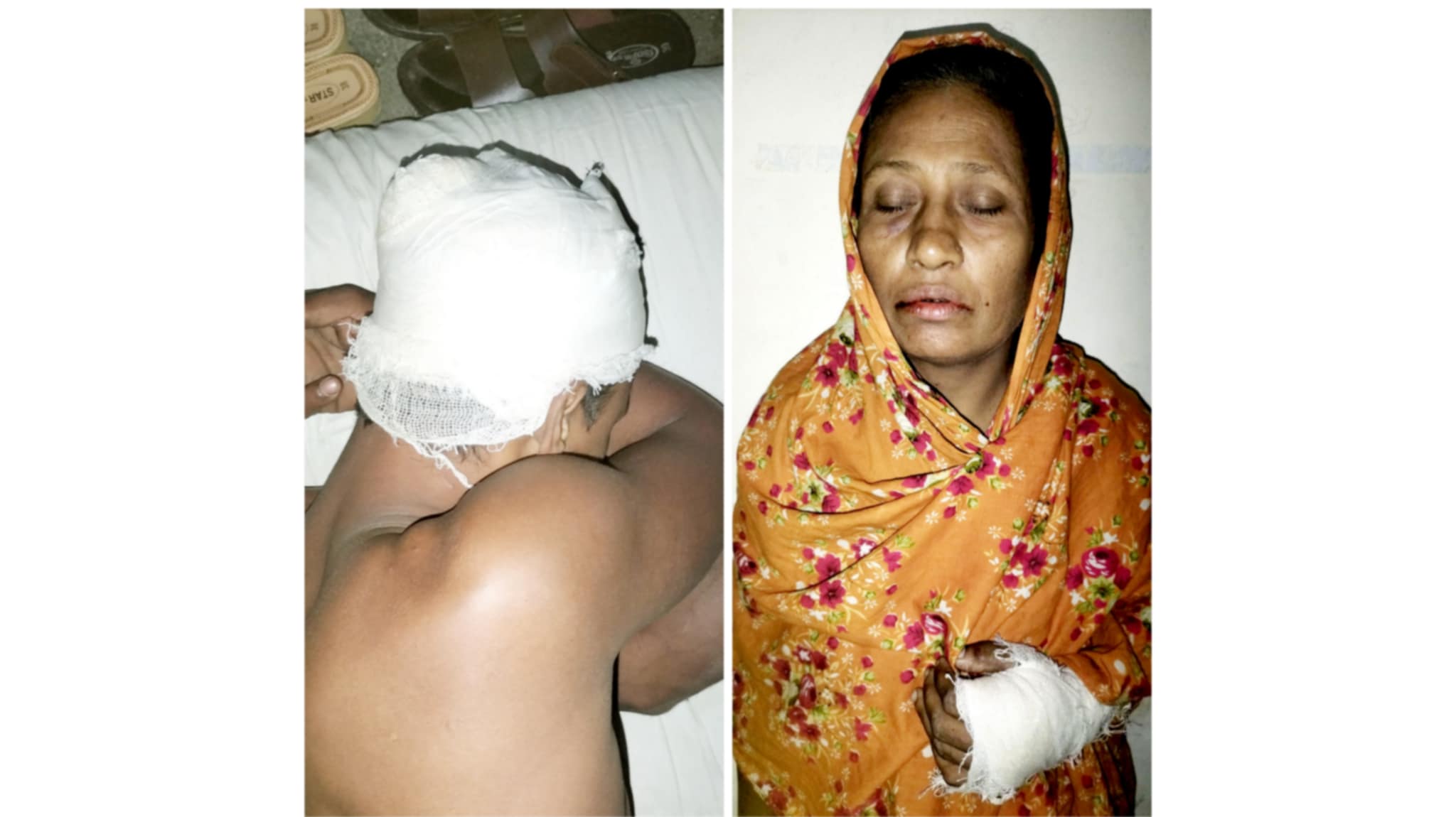 মির্জাগঞ্জে মা-ছেলেকে কুপিয়ে জখমের অভিযোগ