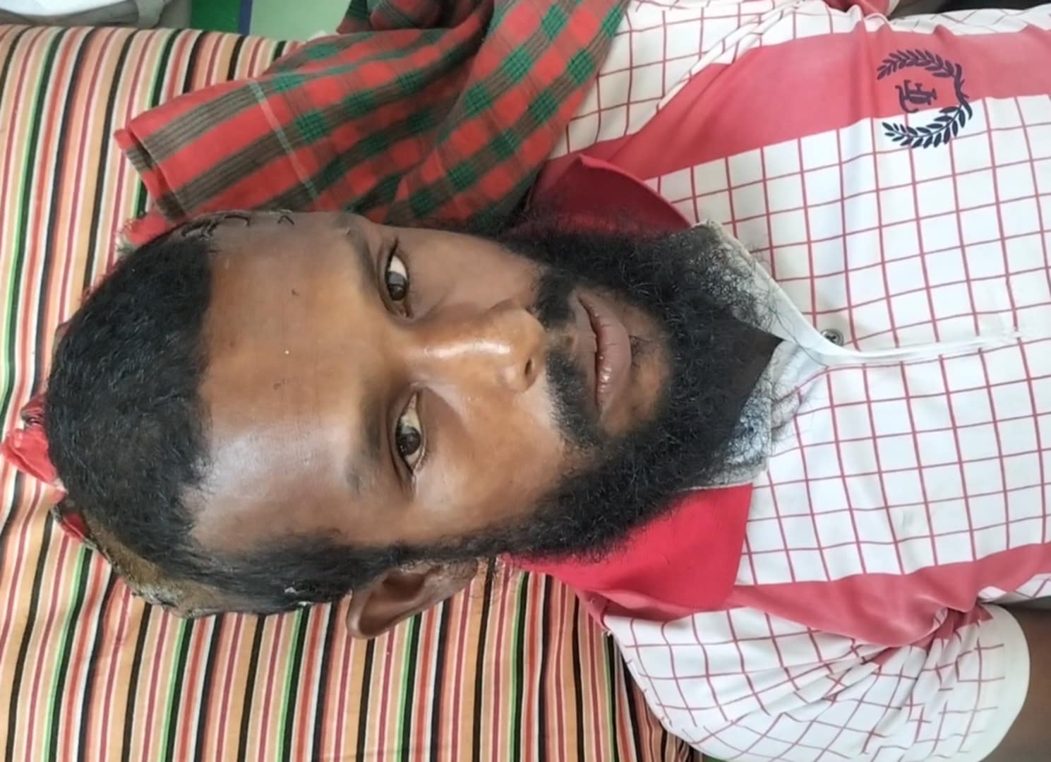 কলাপাড়ায় তুচ্ছ ঘটনায় দিনমজুরকে পিটিয়ে জখমের অভিযোগ