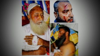 নলছিটিতে যুবলীগ নেতার কোপে রক্তাক্ত চাচা- ভাতিজা সহ ৩ জন হাসপাতালে