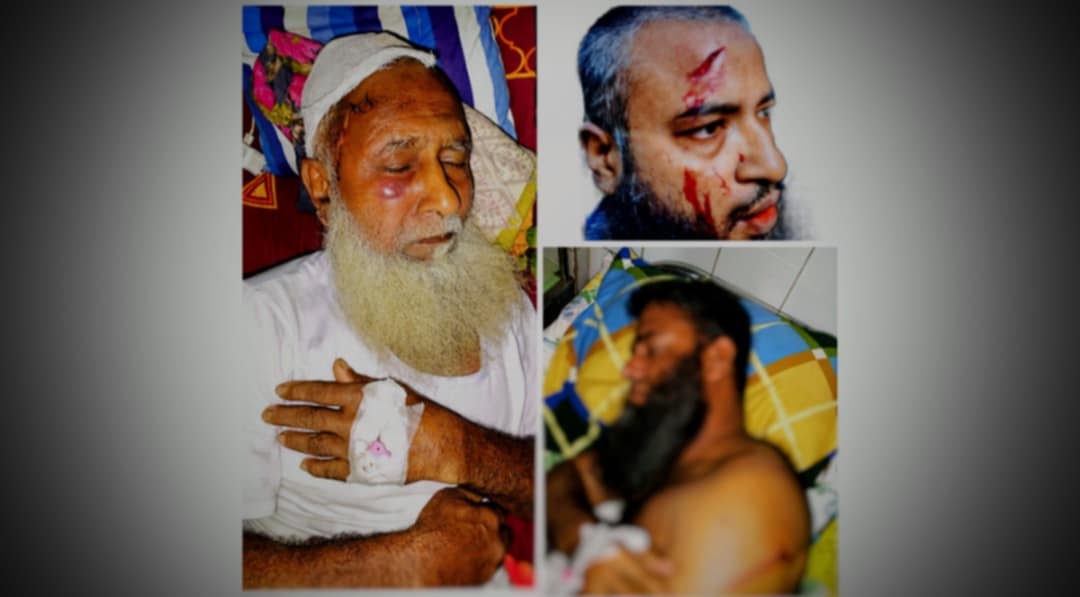 নলছিটিতে যুবলীগ নেতার কোপে রক্তাক্ত চাচা- ভাতিজা সহ ৩ জন হাসপাতালে