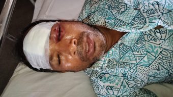 কলাপাড়ায় আইনজীবীকে কুপিয়ে হত্যা চেষ্টার অভিযোগ 