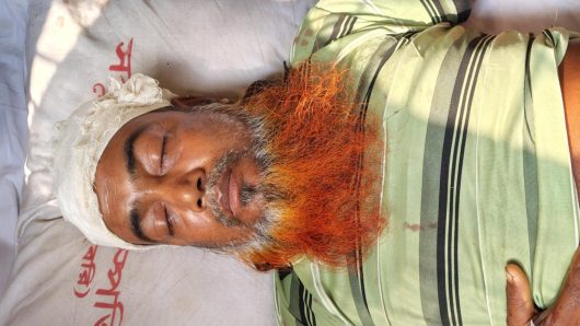 বরগুনায় তুচ্ছ বিষয় নিয়ে দিনমজুরকে কুপিয়ে জখম
