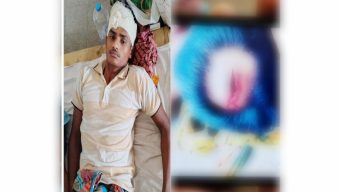 বেতাগীতে সুপারি পাড়াকে কে কেন্দ্র করে সংঘর্ষে আহত ৩