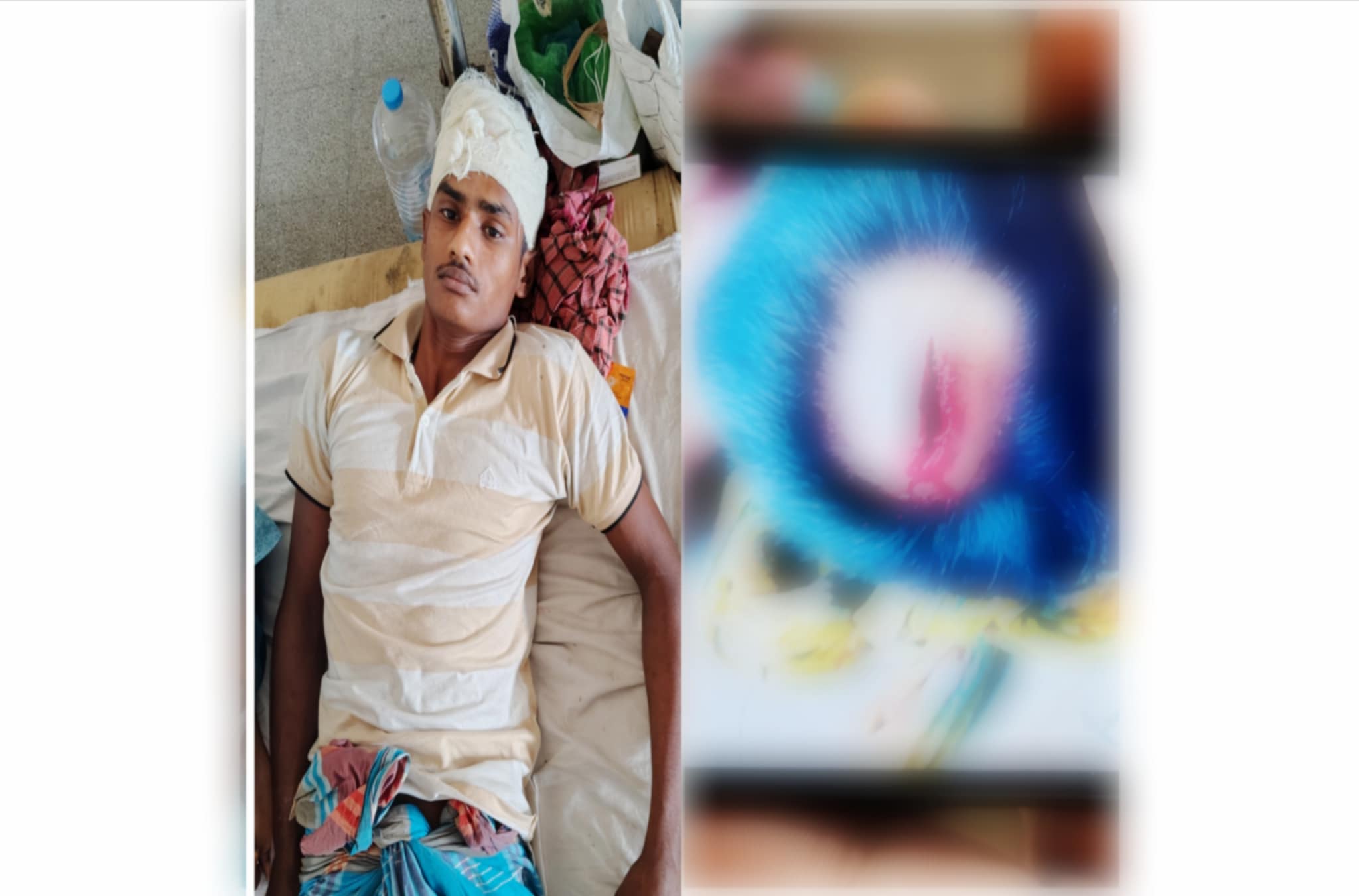 বেতাগীতে সুপারি পাড়াকে কে কেন্দ্র করে সংঘর্ষে আহত ৩