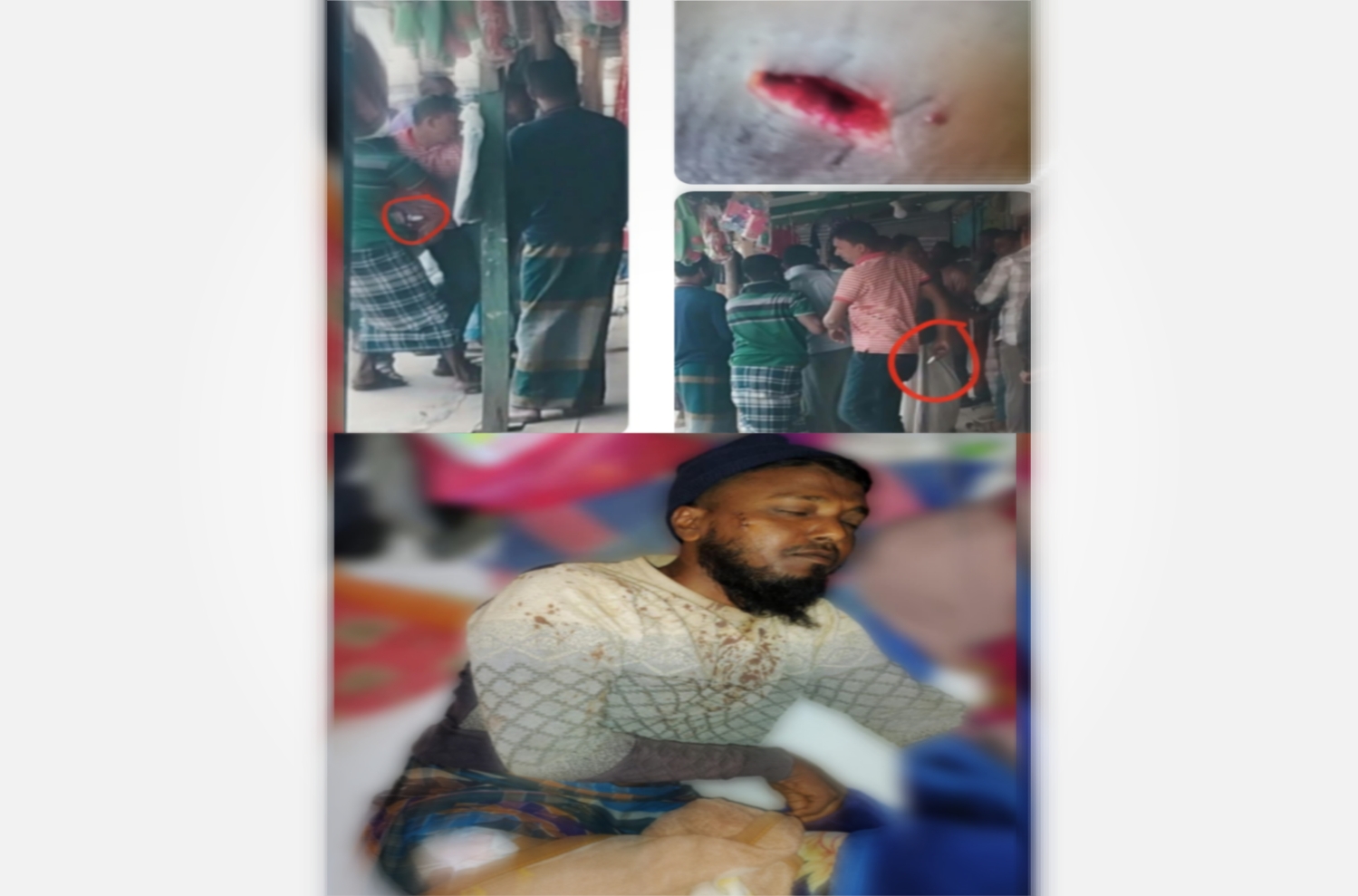 কলাপড়ায় স্বেচ্ছাসেবক দল নেতাকে কুপিয়ে হত্যা চেষ্টার রহস্যের জট উন্মোচন!