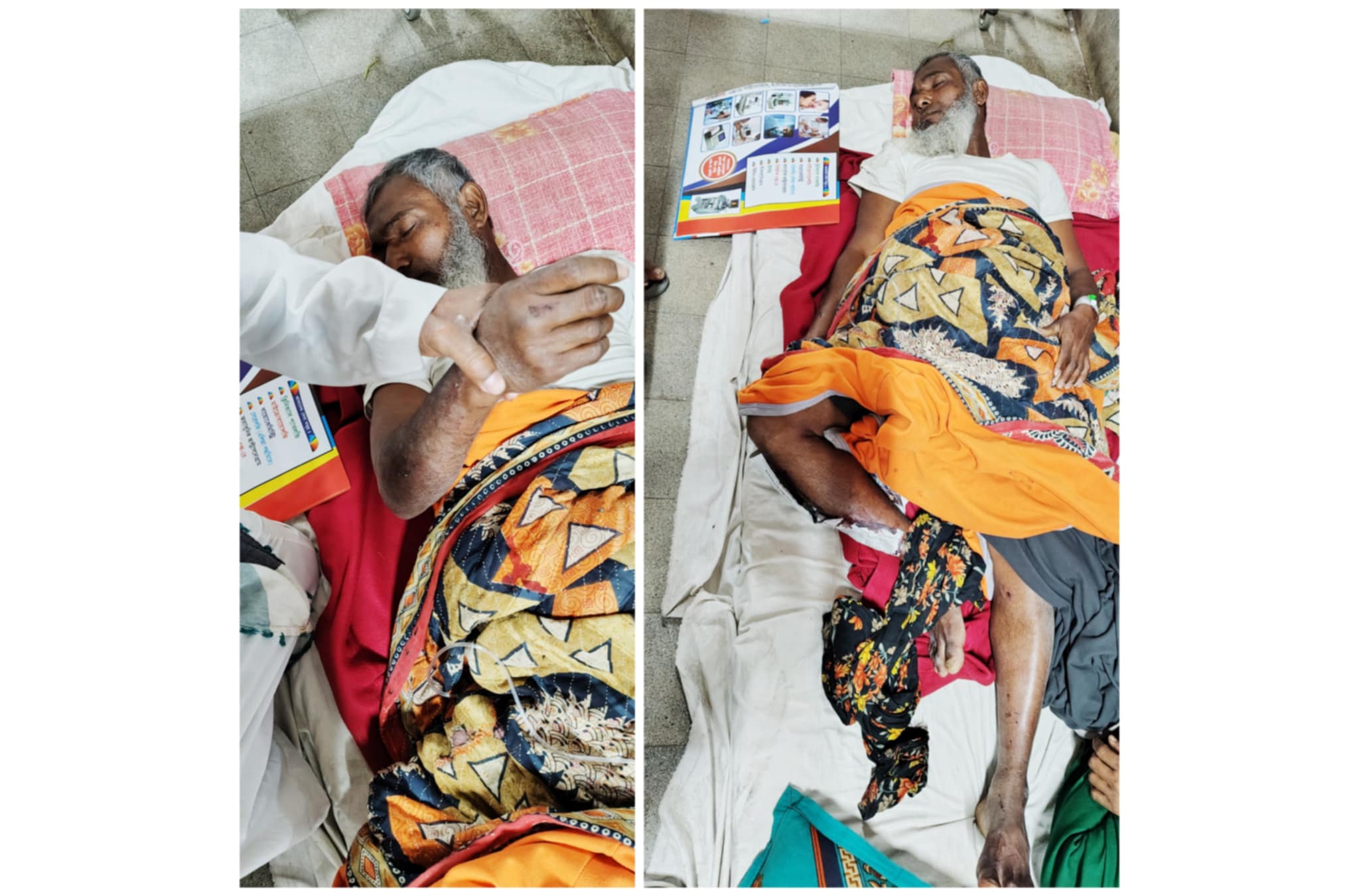 জমি সংক্রান্ত বিরোধে বাবুগঞ্জে দম্পতিকে কুপিয়ে জখম, হাত-পা ভেঙে উল্লাস