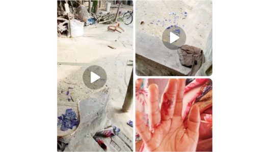 কাউনিয়ার বাটনায় জমি নিয়ে সংঘর্ষে নারীকে পিটিয়ে হাত ভেঙে দেয়ার অভিযোগ