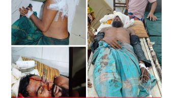 আমতলীতে পাওনা টাকা নিয়ে রক্তক্ষয়ী সংঘর্ষ: নারী-পুরুষ সহ আহত ৪, ১ জন গ্রেফতার, ১ জনকে ঢাকায়